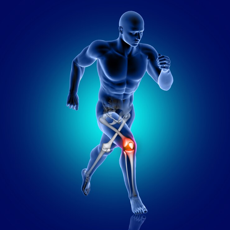 ARTHRITIS AND IT’s TYPES, MANAGEMENT AND TREATMENT IN HOMEOPATHY.