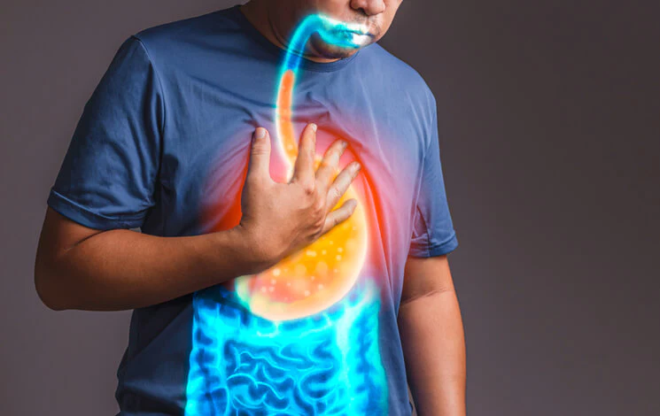 Hyperacidity: Causes, Symptoms, and Management