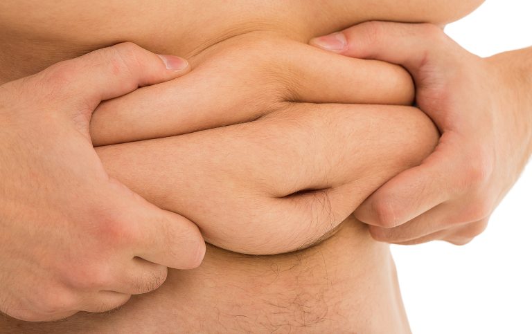 Obesity: A Growing Concern and How to Overcome It